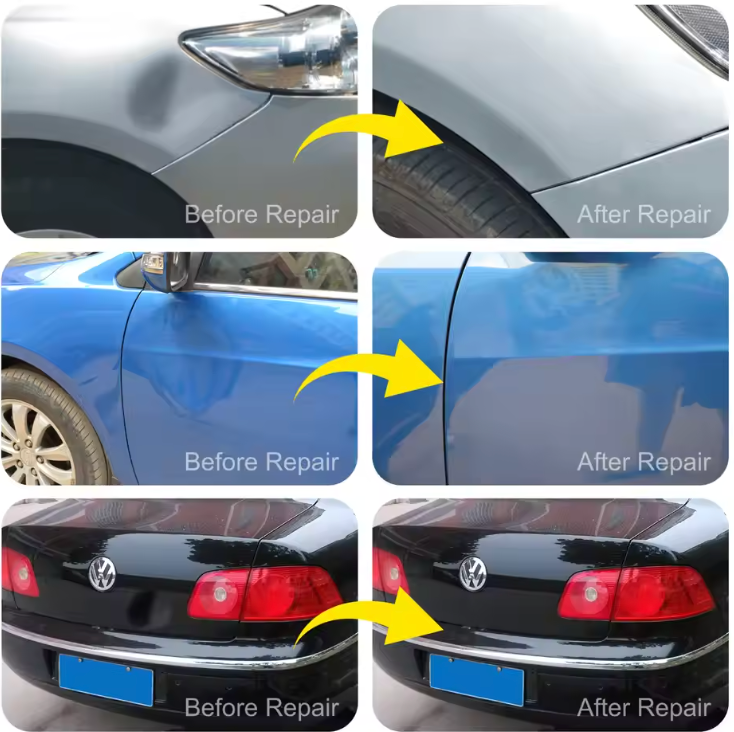 Paintless Dent Removal Kit. Guaranteed Results